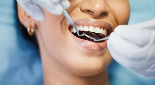 Best Knocked-Out Tooth (Avulsed Tooth) Treatment in Artesia, NM